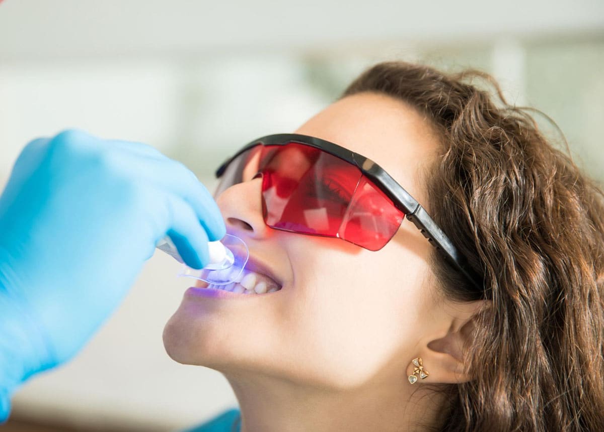 albire dentara chisinau