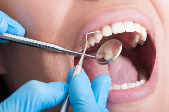 igienizare dentara chisinau