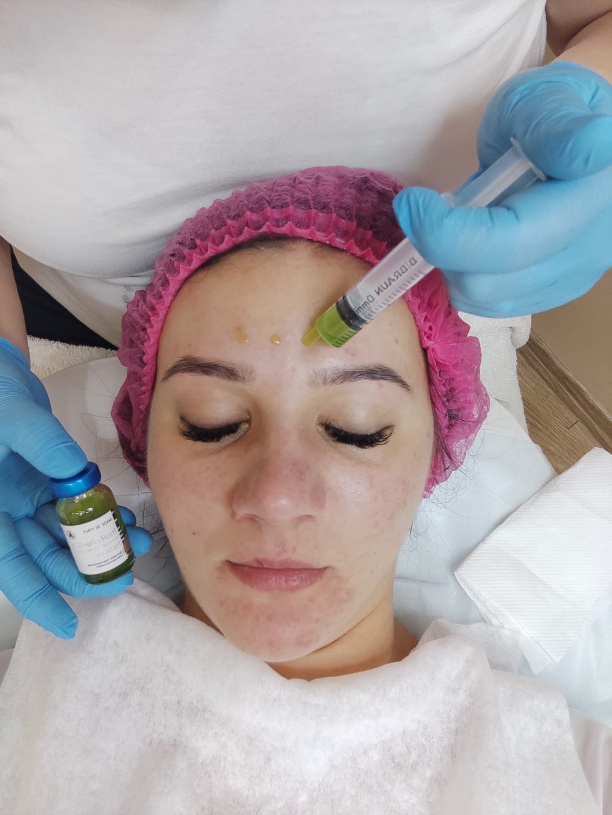 Curățarea facială cu ultrasunete sau combinată (în dependență de tenul dvs)  darsonval ciupi reduceri oferte